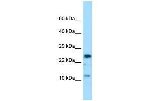 Host: Rabbit Target Name: COX7A2 Sample Type: MCF7 Whole Cell lysates Antibody Dilution: 1.