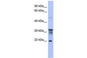 Image no. 1 for anti-Phosphomannomutase 1 (PMM1) (N-Term) antibody (ABIN6744071) (PMM1 Antikörper  (N-Term))