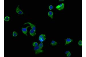 Immunofluorescence staining of MCF-7 cells with ABIN7175412 at 1:200, counter-stained with DAPI. (AVPR2 Antikörper  (AA 221-271))