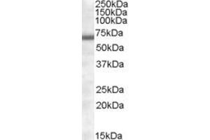 ABIN308432 (1µg/ml) staining of Human Heart lysate (35µg protein in RIPA buffer).