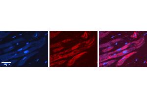 Rabbit Anti-ALAD Antibody   Formalin Fixed Paraffin Embedded Tissue: Human heart Tissue Observed Staining: Cytoplasmic Primary Antibody Concentration: 1:100 Other Working Concentrations: N/A Secondary Antibody: Donkey anti-Rabbit-Cy3 Secondary Antibody Concentration: 1:200 Magnification: 20X Exposure Time: 0.