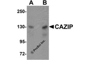 Western Blotting (WB) image for anti-Microtubule-associated Tumor Suppressor Candidate 2 (MTUS2) (C-Term) antibody (ABIN1030322) (CAZIP Antikörper  (C-Term))