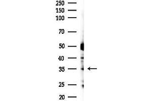 anti-Heterogeneous Nuclear Ribonucleoprotein A2/B1 (HNRNPA2B1) (N-Term) antibody