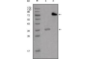 Western Blotting (WB) image for anti-Lipoma-preferred partner (LPP) antibody (ABIN2464077) (LPP Antikörper)