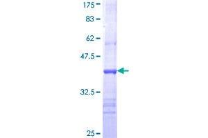 Choline Acetyltransferase Protein (AA 649-748) (GST tag)