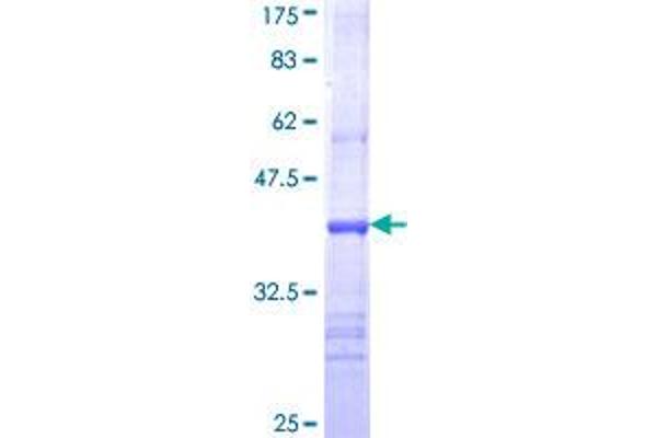 Choline Acetyltransferase Protein (AA 649-748) (GST tag)