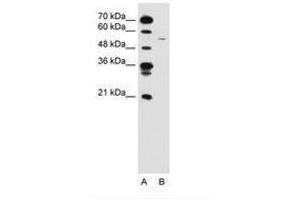 Image no. 1 for anti-Cyclin B1 (CCNB1) (C-Term) antibody (ABIN6736592) (Cyclin B1 Antikörper  (C-Term))