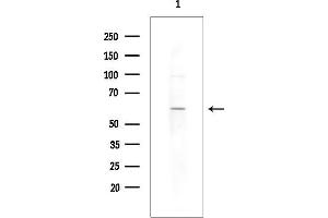 anti-Ankyrin Repeat and BTB (POZ) Domain Containing 1 (ABTB1) antibody