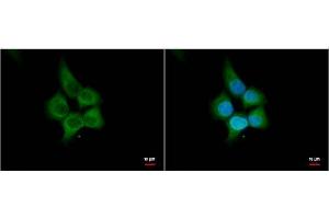 ICC/IF Image HHIP antibody [N3C2], Internal antibody detects HHIP protein by immunofluorescent analysis. (HHIP Antikörper)
