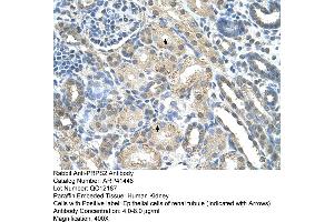 Rabbit Anti-PRPS2 Antibody  Paraffin Embedded Tissue: Human Kidney Cellular Data: Epithelial cells of renal tubule Antibody Concentration: 4. (PRPS2 Antikörper  (Middle Region))