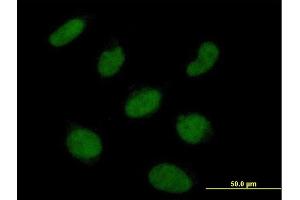 Immunofluorescence of purified MaxPab antibody to RNF113A on HeLa cell. (RNF113A Antikörper)