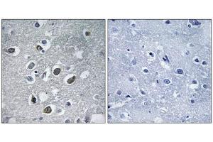 Immunohistochemistry analysis of paraffin-embedded human brain tissue using MARCH4 antibody.