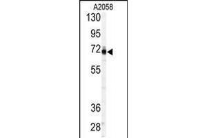 Western blot analysis of anti-P in A2058 cell line lysates (35ug/lane).