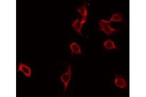 ABIN6276930 staining NIH-3T3 by IF/ICC. (GLB1 Antikörper  (Internal Region))