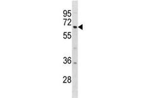DYRK1B antibody western blot analysis in 293 lysate. (DYRK1B Antikörper  (AA 377-405))