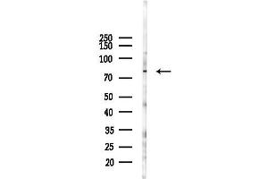 Western blot analysis of lysates from F10-LUC cells(heat-shock 45 min treatment), using IL17RD Antibody at 1/1000 dilution.