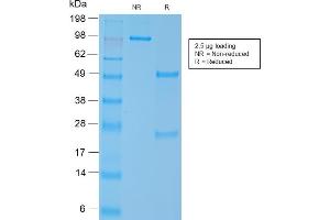 SDS-PAGE Analysis Purified SM-MHC Recombinant Rabbit Monoclonal Antibody (MYH11/2303R). (Rekombinanter MYH11 Antikörper)