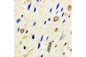 Immunohistochemical analysis of CD59 staining in mouse brain formalin fixed paraffin embedded tissue section. (CD59 Antikörper)
