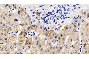 Detection of AIF in Human Liver Tissue using Polyclonal Antibody to Apoptosis Inducing Factor (AIF) (AIF Antikörper  (AA 103-322))