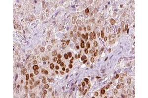 ABIN6266720 at 1/100 staining human liver tissue sections by IHC-P. (REV3L Antikörper  (N-Term))