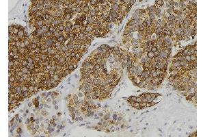 ABIN6277898 at 1/100 staining Human pancreas tissue by IHC-P. (Renin Antikörper  (Internal Region))