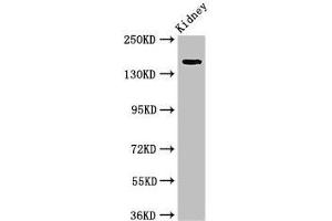 Western Blot Positive WB detected in: Rat kidney tissue All lanes: USP6 antibody at 4 μg/mL Secondary Goat polyclonal to rabbit IgG at 1/50000 dilution Predicted band size: 159, 122, 90 kDa Observed band size: 159 kDa (USP6 Antikörper  (C-Term))