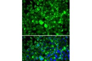 Immunofluorescence analysis of MCF7 cells using RPLP1 Polyclonal Antibody (RPLP1 Antikörper)