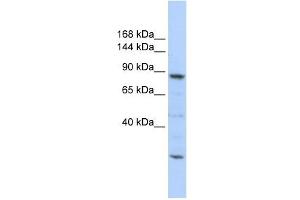 CDC5L antibody used at 1 ug/ml to detect target protein.