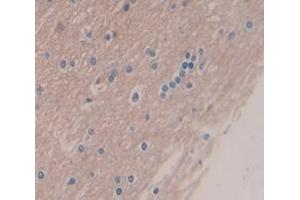 Immunohistochemistry (IHC) image for anti-Creatine Kinase, Muscle (CKM) (AA 11-367) antibody (ABIN1172305)