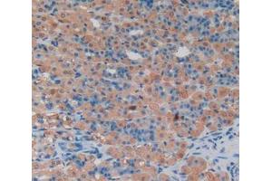 IHC-P analysis of stomach tissue, with DAB staining. (LCN8 Antikörper  (AA 25-176))