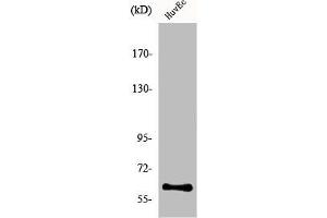 Western Blot analysis of COLO205 cells using hnRNP LL Polyclonal Antibody (HNRPLL Antikörper  (Internal Region))
