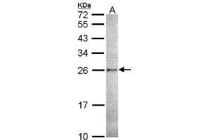CASP14 Antikörper  (C-Term)