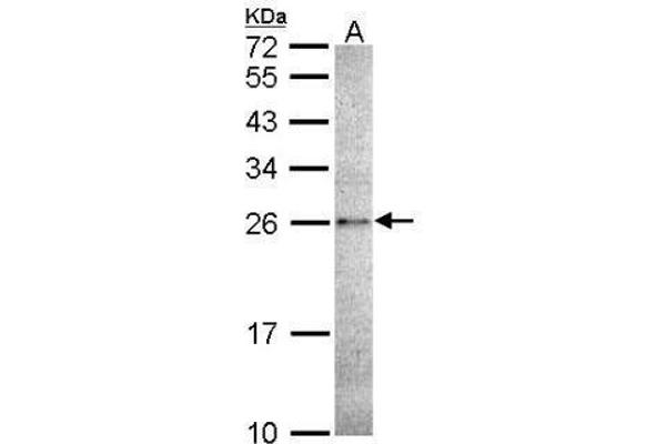 CASP14 Antikörper  (C-Term)