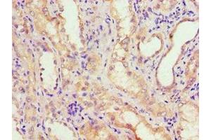 Immunohistochemistry of paraffin-embedded human kidney tissue using ABIN7143650 at dilution of 1:100 (ADH4 Antikörper  (AA 1-380))