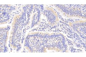 Detection of PTPN22 in Human Small intestine Tissue using Polyclonal Antibody to Protein Tyrosine Phosphatase, Non Receptor Type 22 (PTPN22) (PTPN22 Antikörper  (AA 1-233))