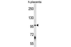 ZFYVE1 Antibody (N-term) western blot analysis in human placenta tissue lysates (35 µg/lane).