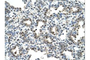 Immunohistochemistry (IHC) image for anti-Osteoactivin (GPNMB) (N-Term) antibody (ABIN2781894)