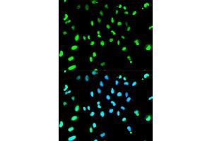 Immunofluorescence analysis of HeLa cells using TARDBP antibody. (TARDBP Antikörper)