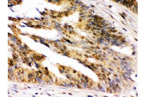 Immunohistochemistry (Paraffin-embedded Sections) (IHC (p)) image for anti-Ubiquitin-Like with PHD and Ring Finger Domains 2, E3 Ubiquitin Protein Ligase (UHRF2) (AA 15-54), (N-Term) antibody (ABIN3044559)