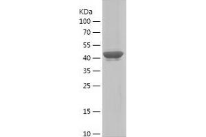 Western Blotting (WB) image for Myosin Heavy Chain 1, Skeletal Muscle, Adult (MYH1) (AA 449-651) protein (His-IF2DI Tag) (ABIN7283124) (MYH1 Protein (AA 449-651) (His-IF2DI Tag))