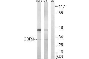 Immunohistochemistry analysis of paraffin-embedded human colon carcinoma tissue, using CBR3 antibody. (CBR3 Antikörper)