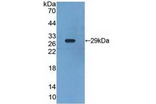 Retinoid X Receptor gamma Antikörper  (AA 12-220)