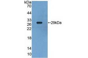 Detection of Recombinant RXRg, Human using Polyclonal Antibody to Retinoid X Receptor Gamma (RXRg) (Retinoid X Receptor gamma Antikörper  (AA 12-220))