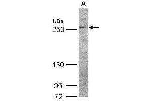 WB Image Sample (30 ug of whole cell lysate) A: IMR32 5% SDS PAGE antibody diluted at 1:500 (THADA Antikörper  (C-Term))