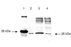 Immunoblot using DIABLO polyclonal antibody  detects a 26 kDa band when 1 ug of recombinant DIABLO is applied (lane 1). (DIABLO Antikörper  (AA 56-239))