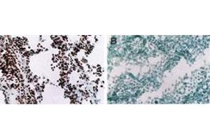 MyoD Immunohistochemistry. (MYOD1 Antikörper  (Internal Region))