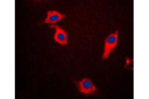 Immunofluorescent analysis of Beta-synuclein staining in HeLa cells. (beta Synuclein Antikörper  (C-Term))