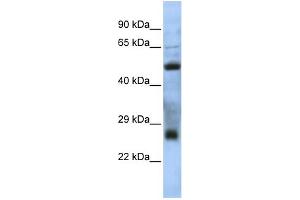WB Suggested Anti-MGC26647 Antibody Titration: 0. (MGC26647 (N-Term) Antikörper)
