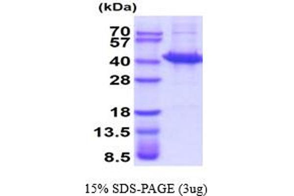 SORD Protein (AA 1-357)