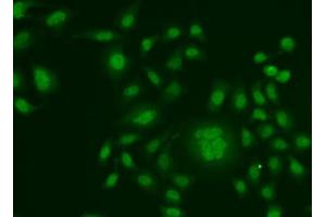 Immunofluorescence analysis of HeLa cells using ERCC1 antibody. (ERCC1 Antikörper  (AA 1-323))